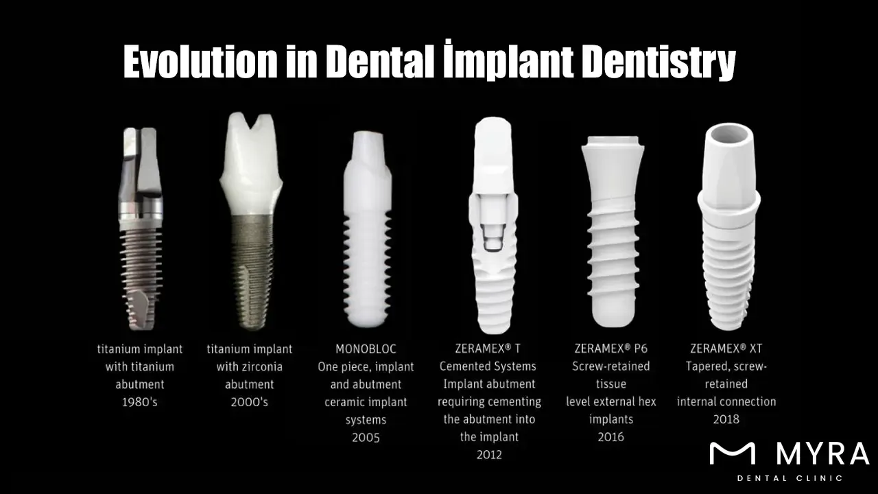 Evolution in Dental İmplant Dentistry.webp
